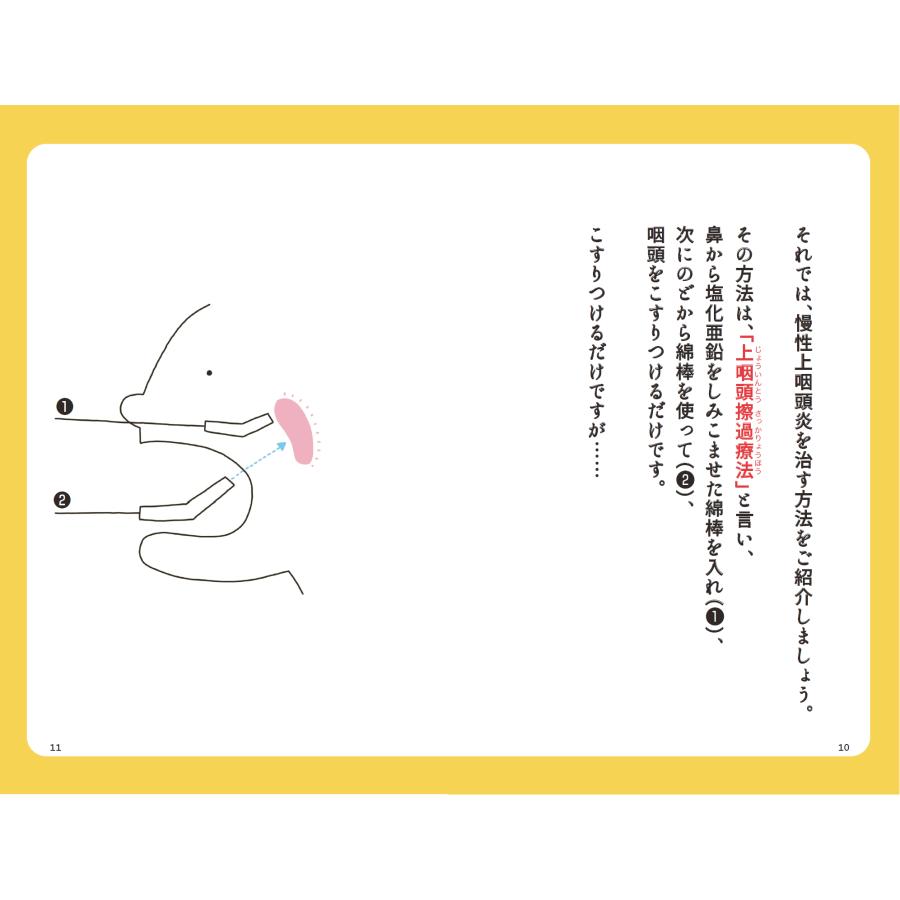 MSMプレフィア150ml「つらい不調が続いたら慢性上咽頭炎を治しなさい」セット |  | 07