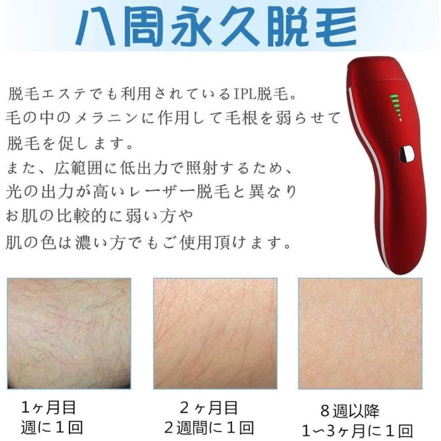 最新のデザイン 足 Vio 背中 腕 わき メンズ レディース 永久脱毛 光脱毛器 脱毛器 Hatsubi 顔 万発美 50万発脱毛照射 全身ムダ毛処理 ボディ フェイスケア