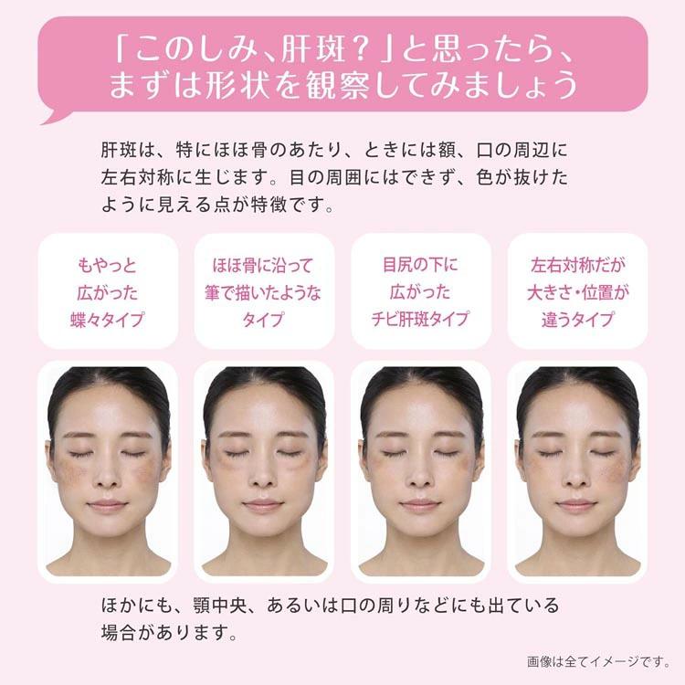 第1類医薬品】 トランシーノEX120錠 ☆使用期限2026年9月☆ : IRIS