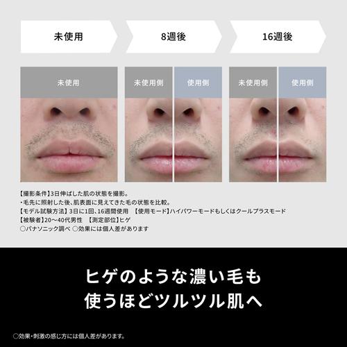 【今なら5年延長保証加入が無料】ES-WG0B-H パナソニック 光エステ スムースエピ パワー＆クール グレー 光美容器 脱毛器の画像