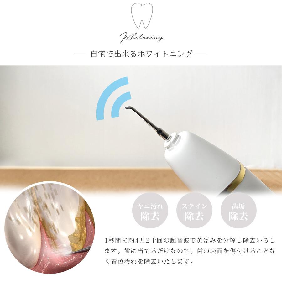 電動歯ブラシ シャイニーキャビテック 歯ブラシ 替え 自宅で出来る