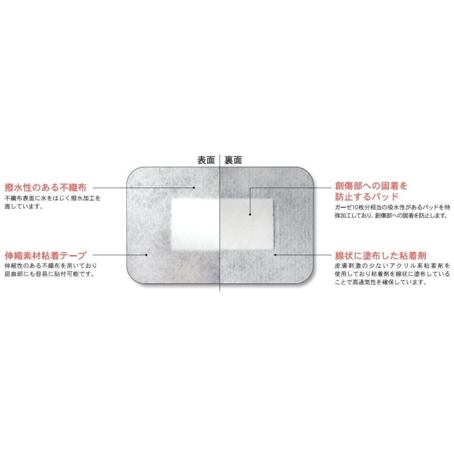 ミリオンエイド 粘着パット No.50 創傷部被覆保護ドレッシング 共和 4971620846056 | 共和 | 03