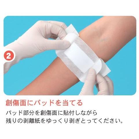 共和 ミリオンエイド 粘着パット No.60 創傷部被覆保護 共和 ミリオンエイド 粘着パット No.60 創傷部被覆保護