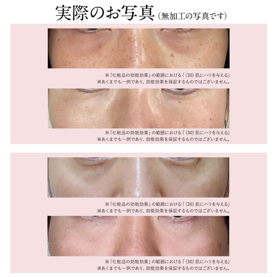 北の快適工房 【公式】目の下 ヒアルロン酸 パッチ ヒアロディープ