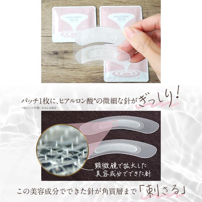 北の快適工房 【お得セット】『リフィスト』×『ヒアロディープパッチ