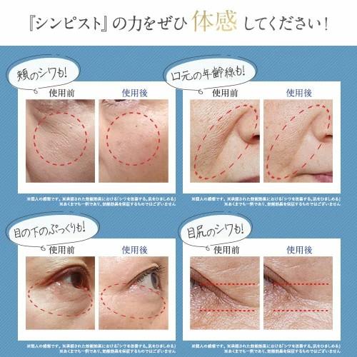 北の快適工房 オールインワンジェル 美白 シワ改善 ナイアシン 北の快適工房 オールインワンジェル 美白 シワ改善 ナイアシン