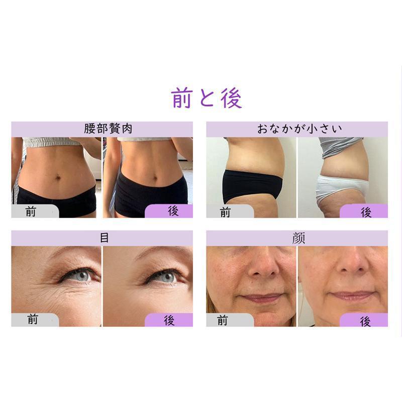 数量限定，定番 1台6役 40KHzキャビテーションマシン 超音波 RFラジオ