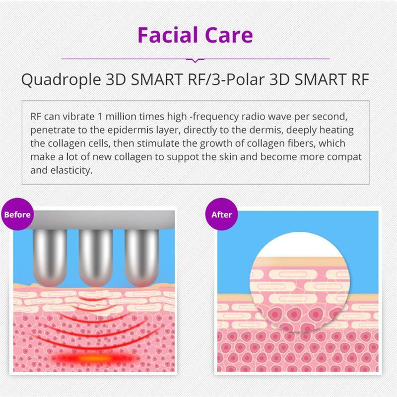 キャビテーションマシン ラジオ波 RF 温熱ケア 美容器 業務用 家庭用 1台5