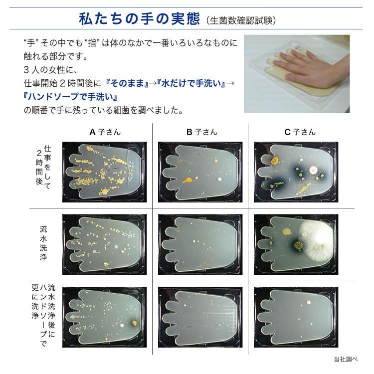 コンタクト装着補助器具 メルル 世界初 レンズにまったく手を触れず ソフトコンタクト カラコンの装脱着 かみ箱 通販 Yahoo ショッピング