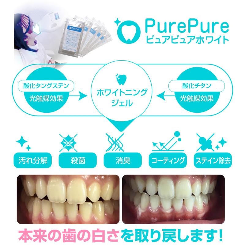 世界初！【専用セルフホワイトニングジェル】ダブル触媒効果の自社