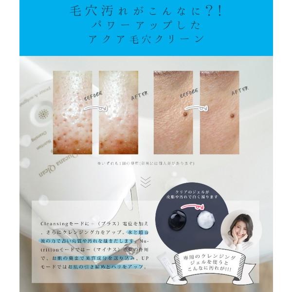 プラソニエ ウォーターピーリング ウォーターピーラー 毛穴ケア 超音波