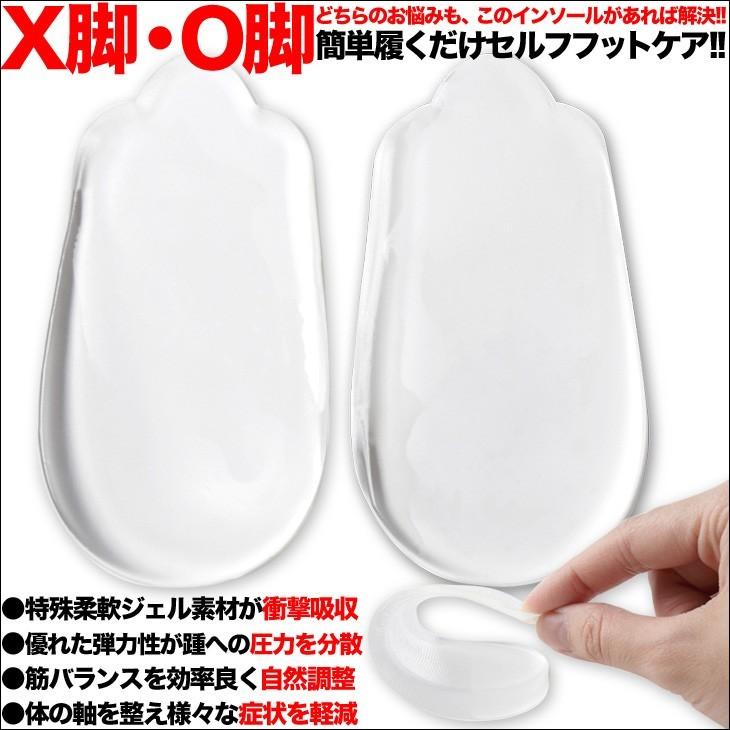 O脚矯正 X脚矯正 O脚 X脚が気になる方に 矯正インソール 2セット入 いつもの靴に入れるだけ コッソリ美しい美脚ラインに 2セット入 O 30 シークレット靴専 通販 Yahoo ショッピング