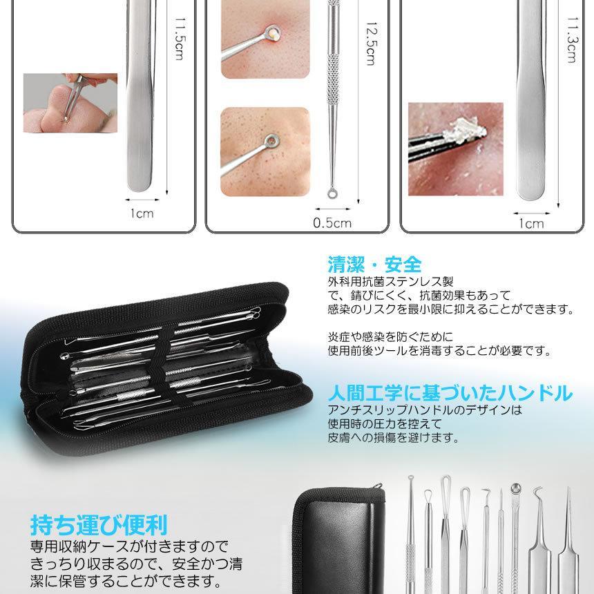 角栓取り ピンセット プッシャー 9本セット ニキビケア 黒ずみ取り 角