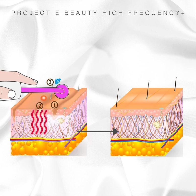 プロジェクトEビューティー高周波デバイス スキンケアデバイス 楽天市場】ヘアタイムセス 27D Plus キューラ 頭皮料(スカルプ