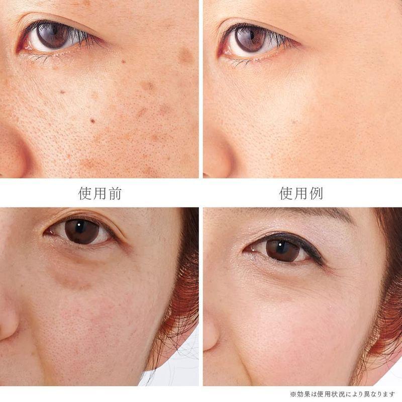 別倉庫からの配送 ニキビ跡 2個販売 Hi Rich そばかす隠し トミーリッチ ファンデーション効果で隠す 赤ら顔を隠す ナチュラルメイク シミ ファンデーション効果でソバカス パウダーファンデーション ベースメイク メイクアップ