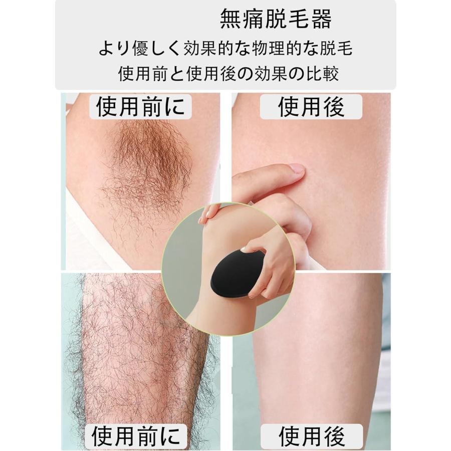 脱毛器 [2025アップグレード] より効果的 無痛脱毛器 ナノガラス