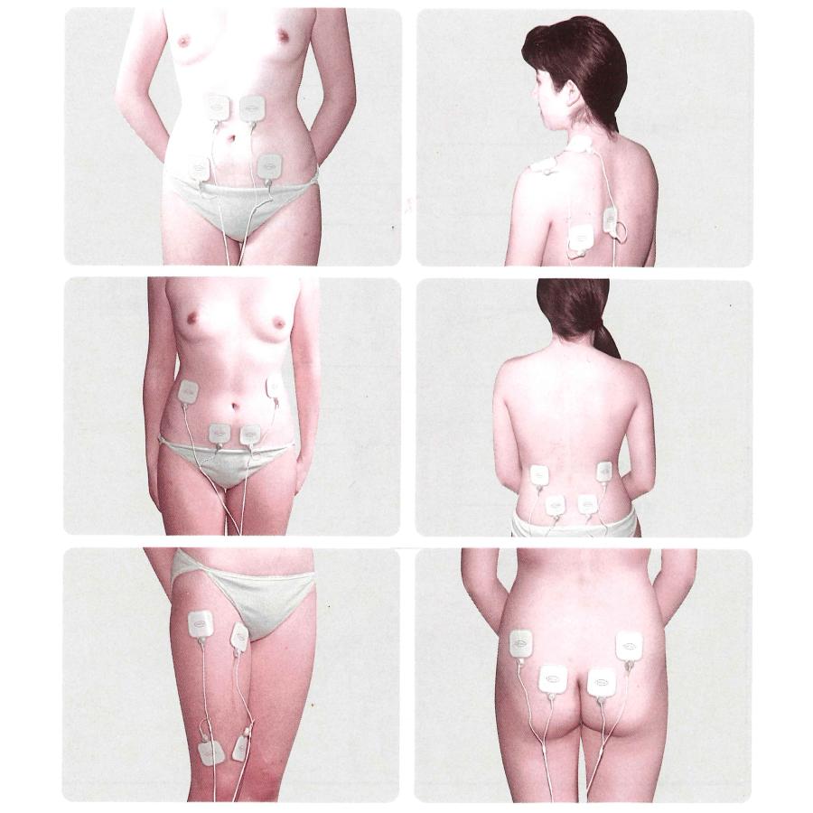 ［中古激安！］整骨院でも使われている低周波機器（バストアップパットあり） 中古激安！］整骨院でも使われている低周波機器（バストアップパットあり）