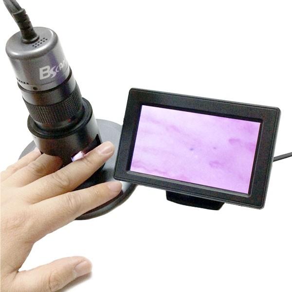 BSCAN血管スコープ