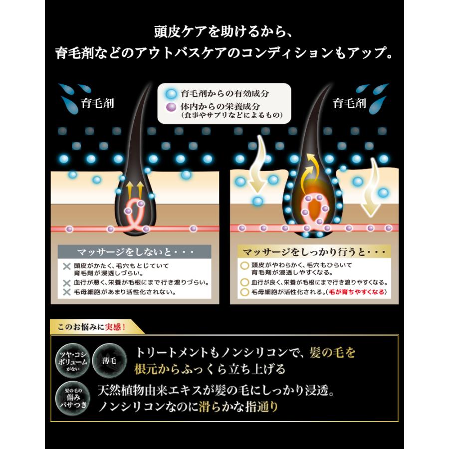 イクオス　サプリ　育毛剤 Amazon.co.jp: イクオス（IQOS）: 育毛剤