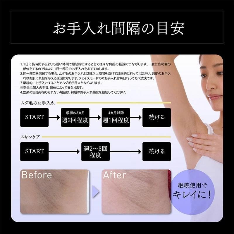 ex-coolflashbeaute 冷却脱毛器 クールフラッシュボーテ