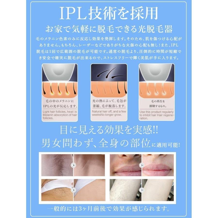 品質満点 Ipl光美容器 家庭用レーザー脱毛器 家庭用レーザー脱毛器 安心安全設計 痛くない設計 永久脱毛 光脱毛 自宅で簡単光脱毛 Ipl光美容器レーザー式脱毛機スキンサイエンス ボディ フェイスケア Www Reinnec Cl