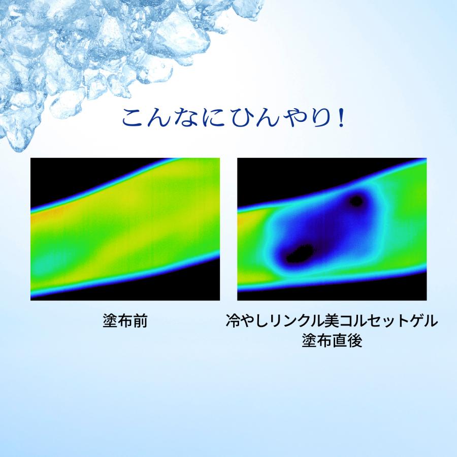 PRIOR 資生堂 プリオール オールインワン 薬用冷やしリンクル美
