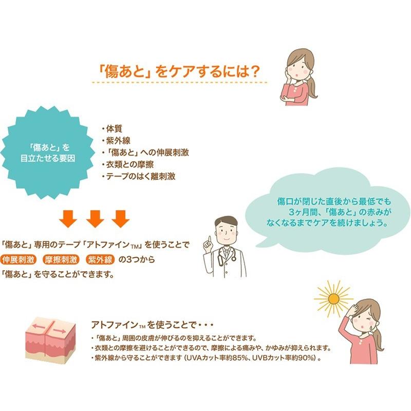 アトファイン Lサイズ (6枚入り) ニチバン 傷あとケア 保護 手術後 低刺激 日本製 簡単ケア(ポスト投函送料無料) :20170714l:健康fan日興メディカル - 通販 - Yahoo!ショッピング アトファイン Lサイズ (6枚入り) ニチバン 傷あとケア 保護 手術後 低刺激 日本製 簡単ケア(ポスト投函送料無料) :20170714l:健康fan日興メディカル - 通販 - Yahoo!ショッピング
