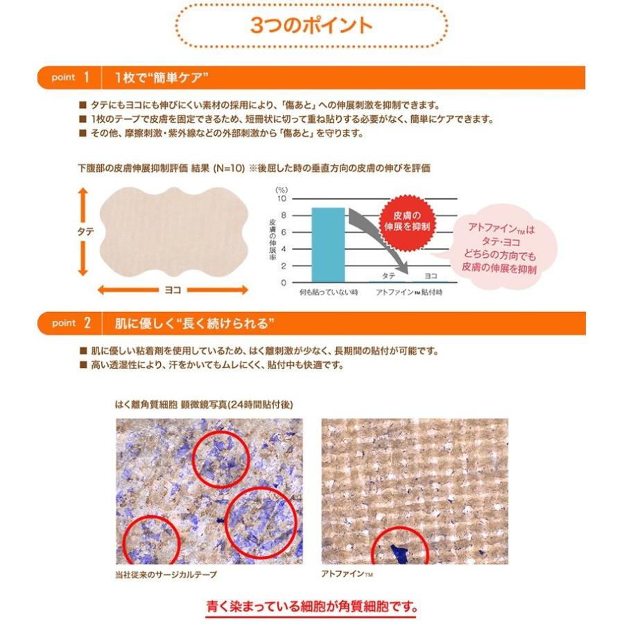 アトファイン Ｌサイズ (6枚入り) ニチバン 傷あとケア 保護 手術後 低刺激 日本製 簡単ケア（ポスト投函送料無料）｜kenko-fan-nikko｜05