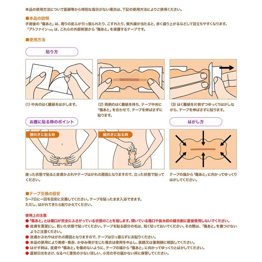 アトファイン Ｌサイズ (6枚入り) ニチバン 傷あとケア 保護 手術後 低刺激 日本製 簡単ケア（ポスト投函送料無料）｜kenko-fan-nikko｜07