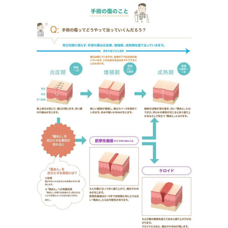 アトファイン LLサイズ (4枚入り) ニチバン 傷あとケア 保護 手術後 低刺激 日本製 簡単ケア（ポスト投函送料無料）｜kenko-fan-nikko｜03