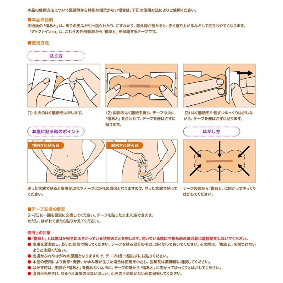 アトファイン Mサイズ 6枚入り ニチバン 傷あとケア 保護 手術後 低