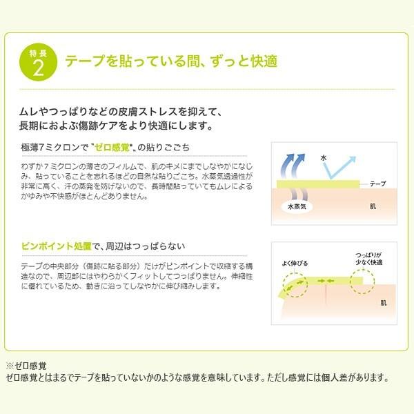 skinix 傷あとケア セット アトレスケア Sサイズ 25mm×50mm 30枚入り
