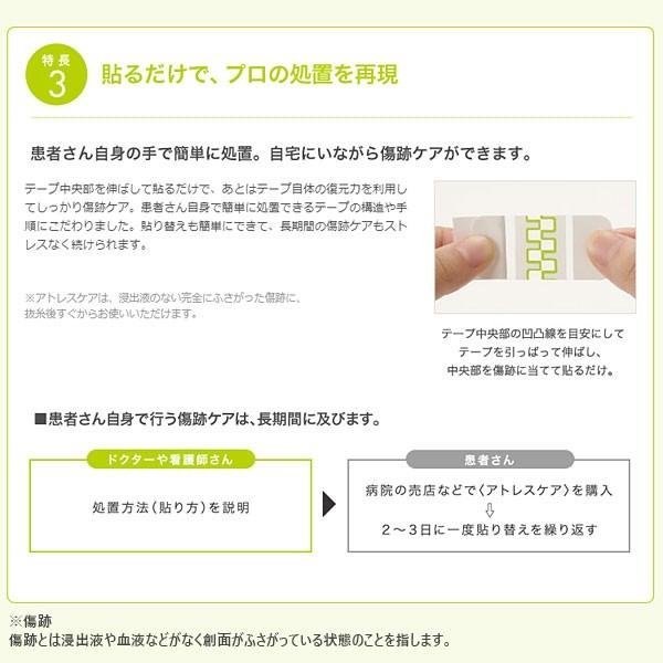 skinix 傷あとケア セット アトレスケア Sサイズ 25mm×50mm 30枚入り