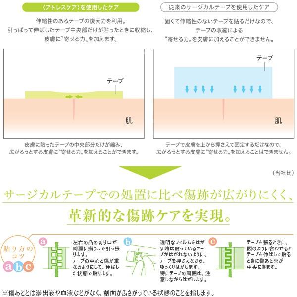 skinix 傷あとケア アトレスケア Sサイズ 30枚入り 25mm×50mm 手術跡