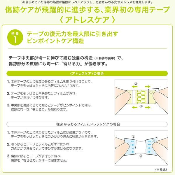 skinix 傷あとケア アトレスケア Mサイズ 10枚入り 50mm×50mm 手術跡