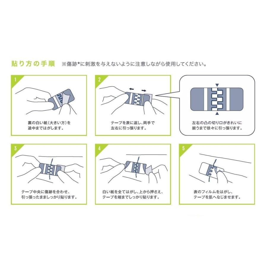 skinix 傷あとケア アトレスケア Mサイズ 10枚入り 50mm×50mm 手術跡