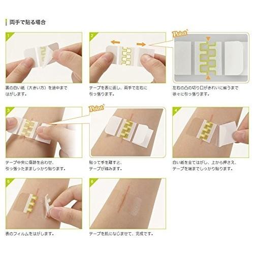 skinix 傷あとケア アトレスケア Mサイズ 10枚入り 50mm×50mm 手術跡