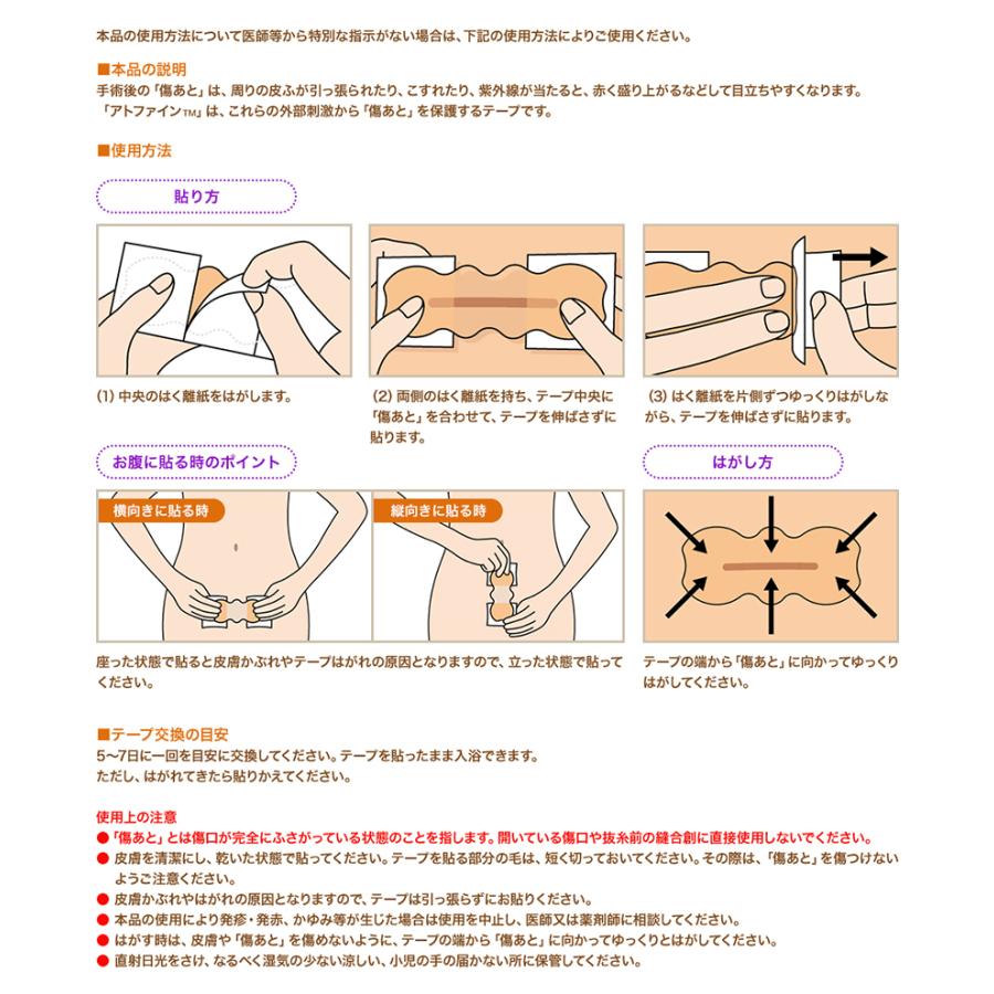 オオサキメディカル 帝王切開 術後セット アトファイン 傷あとケア
