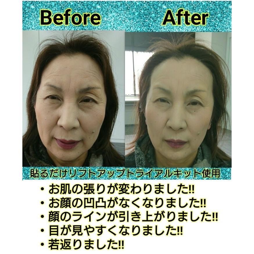 耳ツボジュエリー 耳つぼジュエリー Seal限定商品 スワロフスキー リフト 貼るだけリフトアップトライアルキット3点粒