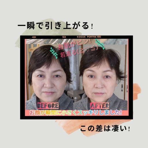 新6色 貼るだけリフトアップトライアルキットジュエリー8粒ジュエリー無し12粒合計20粒 耳ツボジュエリー 耳つぼジュエリー アンチエイジング |kenkou-mimitsubo|05