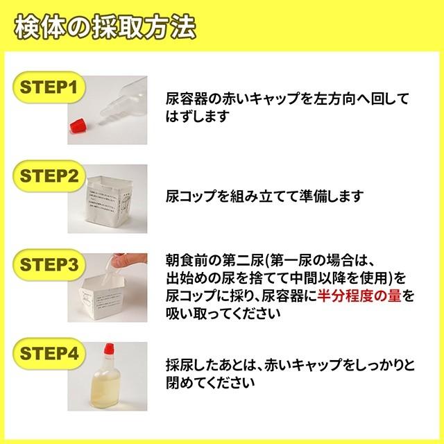 尿検査 3項目（尿糖・尿蛋白・尿潜血） 〜糖尿病や腎臓が心配な方