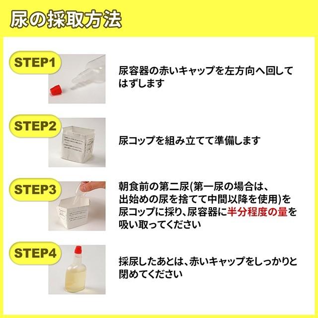 生活習慣病 肝臓病 糖尿病 痛風 尿検査を含むお得な23項目検査 【小型