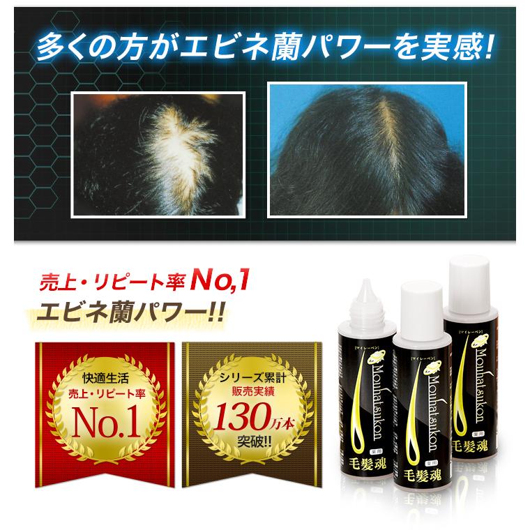 育毛剤  薬用育毛剤 発毛促進  医薬部外品 快適生活 「薬用育毛剤 毛髪魂マイレーベン」３本セット 男性用 日本製 医薬部外品 女性用 育毛トニック 無香料 育毛剤 薬用育毛剤 発毛促進 医薬部外品 快適生活 「薬用育毛剤 毛髪魂