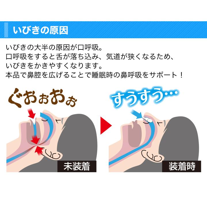 いびき イビキ 安眠 快眠 睡眠 お悩み 鼻 快適生活 一般医療機器「快眠
