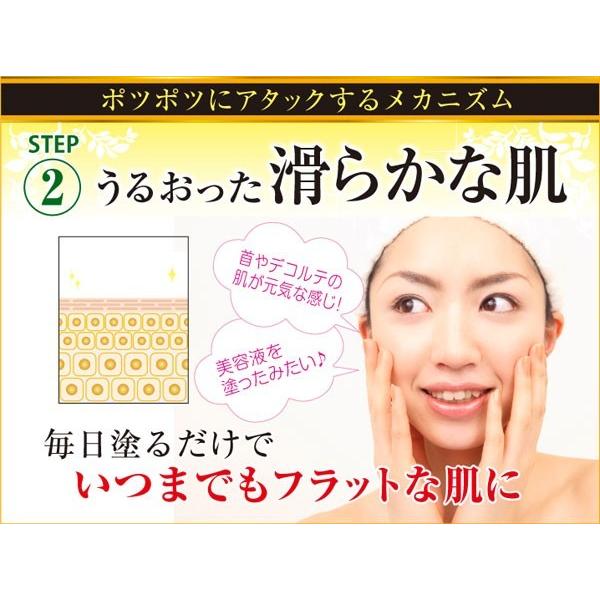 薬用プッチフラットクリーム 15g（医薬部外品）｜kf-tokyo｜05