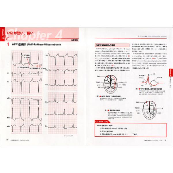 心電図の読み方パーフェクトマニュアル - 理論と波形パターンで徹底トレーニング！｜kinokuniya｜05