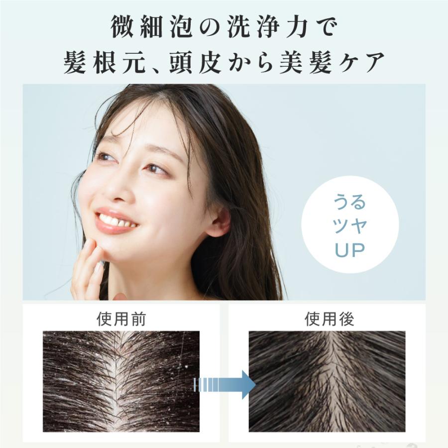 シャワーヘッド スキンケア 節水 高洗浄力 手元止水 うるおい 美肌 ケア 汚れ 除去 6段階モード シャワー 保温 ミスト ペット ナノバブルシャワー zk-swhd01 |  | 05