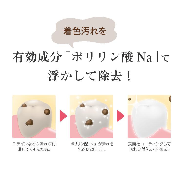 ホワイトニング デンタルホワイトプロイズム ポリリンバブル：2本 