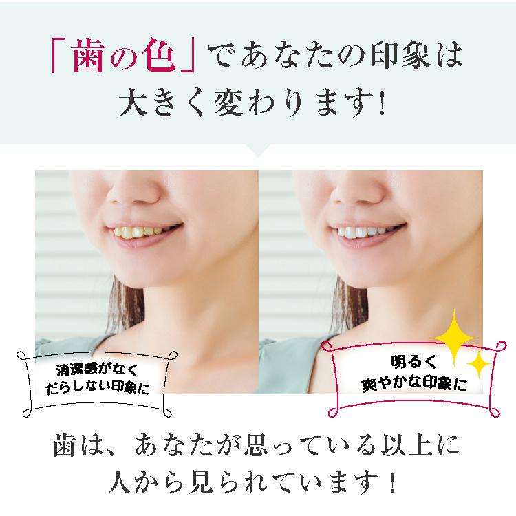 ホワイトニング　デンタルホワイトプロイズム ポリリンバブル：4本セット（特典付き） 歯 ホワイトニング 医薬部外品歯みがき粉 |  | 04