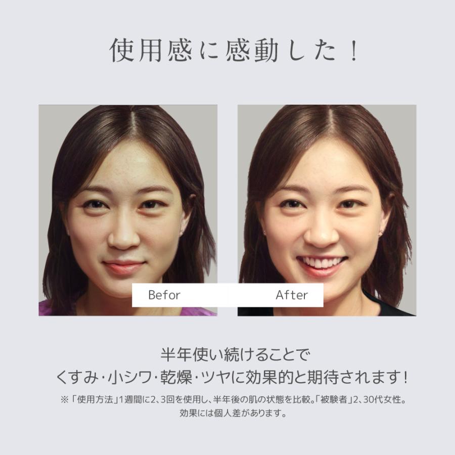 belulu 美顔器 フォトフェイシャル リフトアップ シミ取り belulu 美顔器 フォトフェイシャル リフトアップ シミ取り